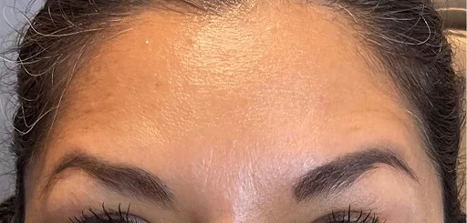 Bundle - Silikonski obliži proti gubam – OČI + ČELO