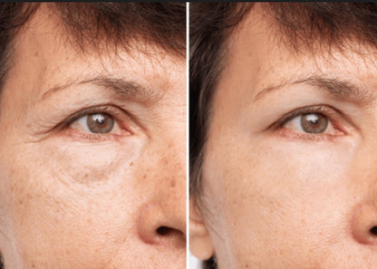 Silikonski obliž za gube okoli oči